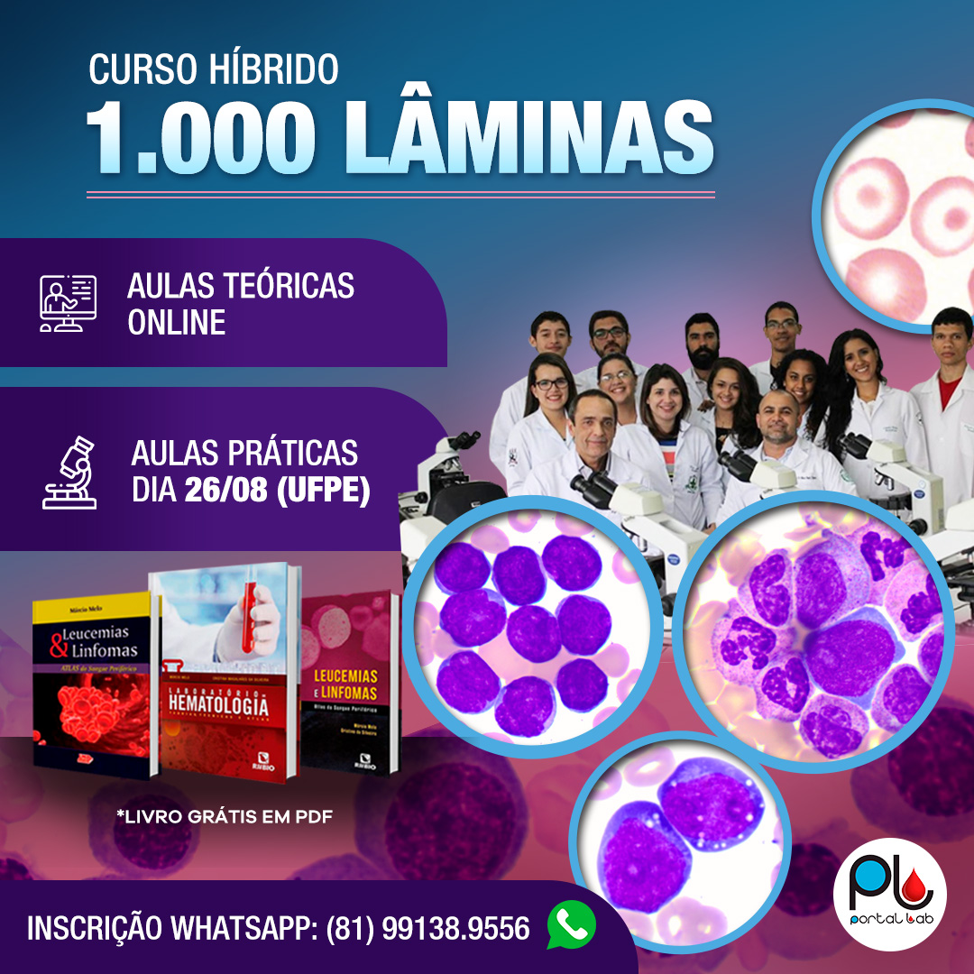 banner 1.000 LÂMINAS