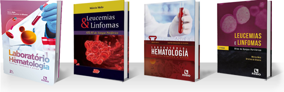 banner LEUCEMIAS E LINFOMAS